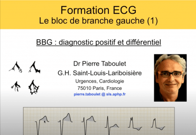 ECG -10