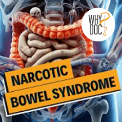 Narcotic Bowel Syndrome